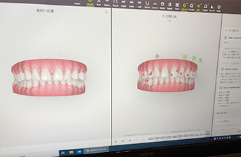 治療計画の確認と承認の写真