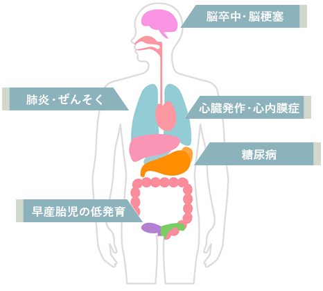 歯周病が全身に与える影響イラスト